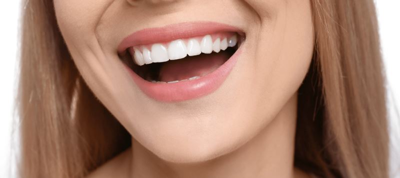 Daha beyaz ve orantılı dişler Hollywood gülüşü ile mümkün