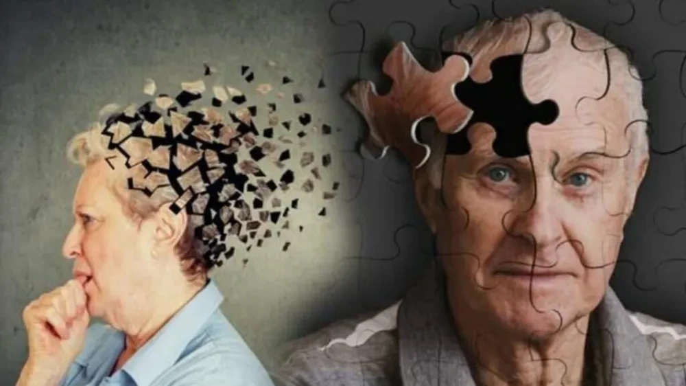Alzheimer başlangıcı depresyonla karıştırılıyor