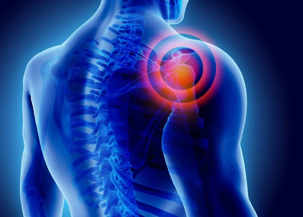 Relieving Shoulder Pain: A Comprehensive Guide